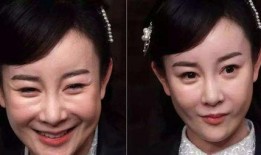 香港艺人爆料整容视频,揭秘明星美容秘密