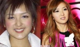 香港艺人爆料整容视频,揭秘明星美容秘密